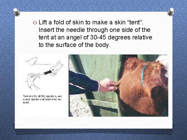 O Lift a fold of skin to make a skin “tent”. Insert the needle