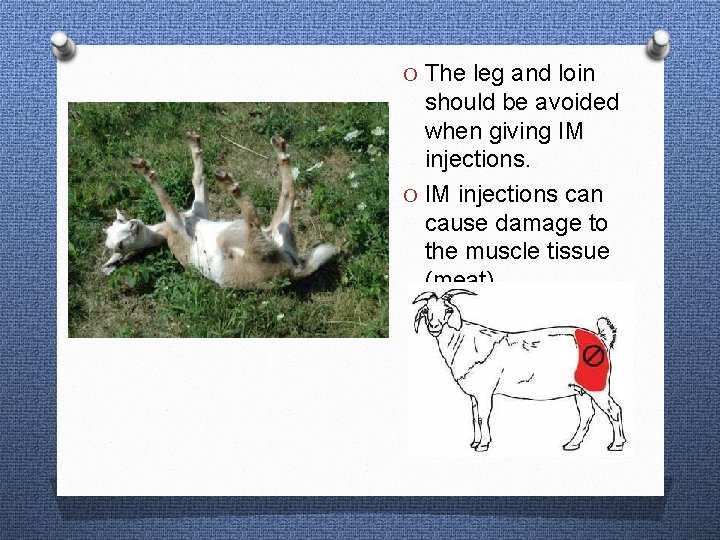 O The leg and loin should be avoided when giving IM injections. O IM