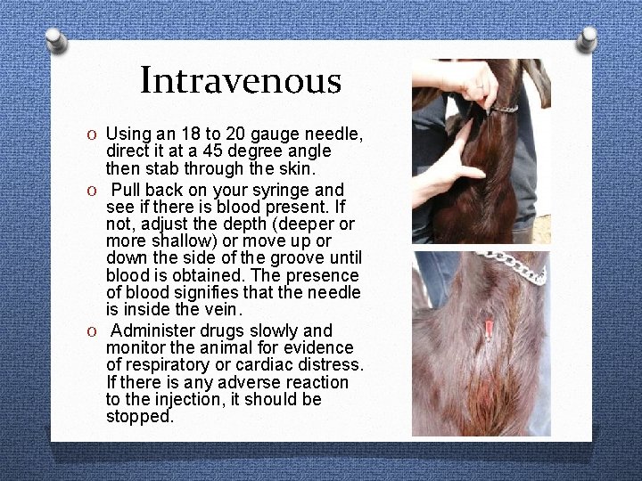 Intravenous O Using an 18 to 20 gauge needle, direct it at a 45