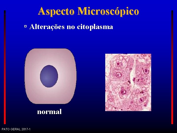 Aspecto Microscópico Alterações no citoplasma normal PATO GERAL 2017 -1 