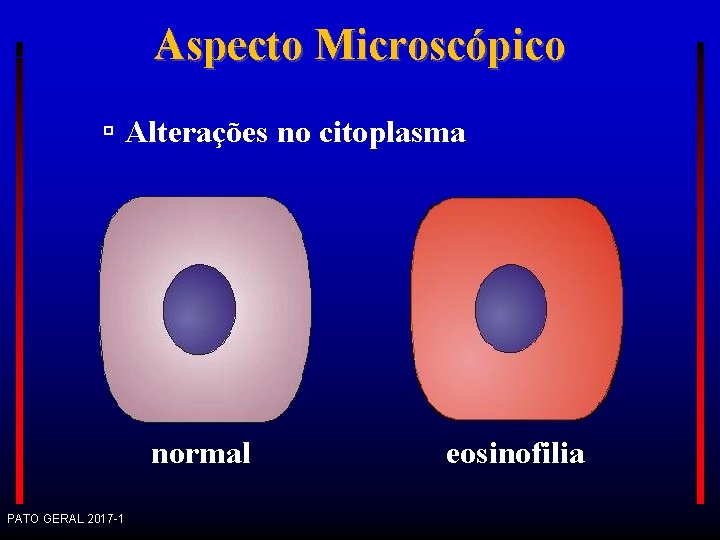 Aspecto Microscópico Alterações no citoplasma normal PATO GERAL 2017 -1 eosinofilia 