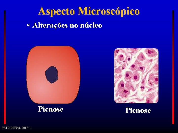 Aspecto Microscópico Alterações no núcleo Picnose PATO GERAL 2017 -1 Picnose 