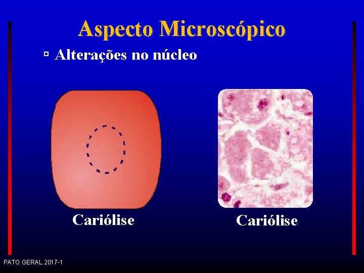 Aspecto Microscópico Alterações no núcleo Cariólise PATO GERAL 2017 -1 Cariólise 