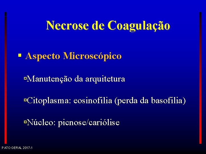 Necrose de Coagulação Aspecto Microscópico Manutenção da arquitetura Citoplasma: eosinofilia (perda da basofilia) Núcleo: