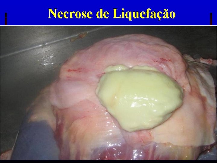 Necrose de Liquefação PATO GERAL 2017 -1 
