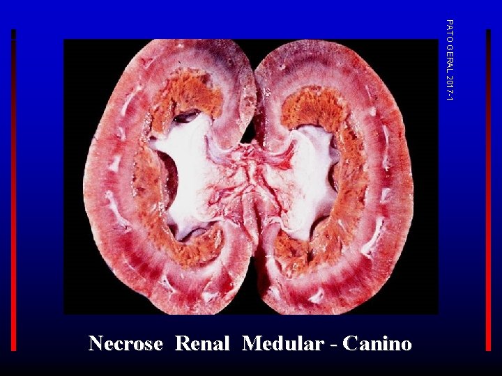 PATO GERAL 2017 -1 Necrose Renal Medular - Canino 