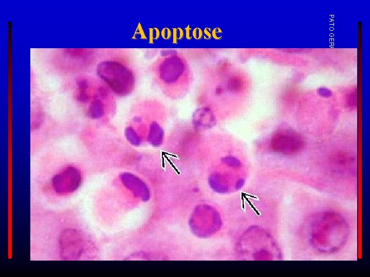 PATO GERAL 2017 -1 Apoptose 