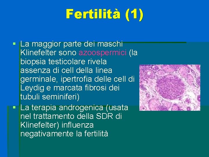 Fertilità (1) § La maggior parte dei maschi Klinefelter sono azoospermici (la biopsia testicolare