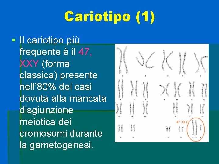 Cariotipo (1) § Il cariotipo più frequente è il 47, XXY (forma classica) presente