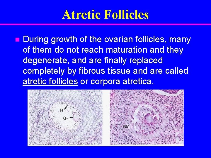 Atretic Follicles n During growth of the ovarian follicles, many of them do not
