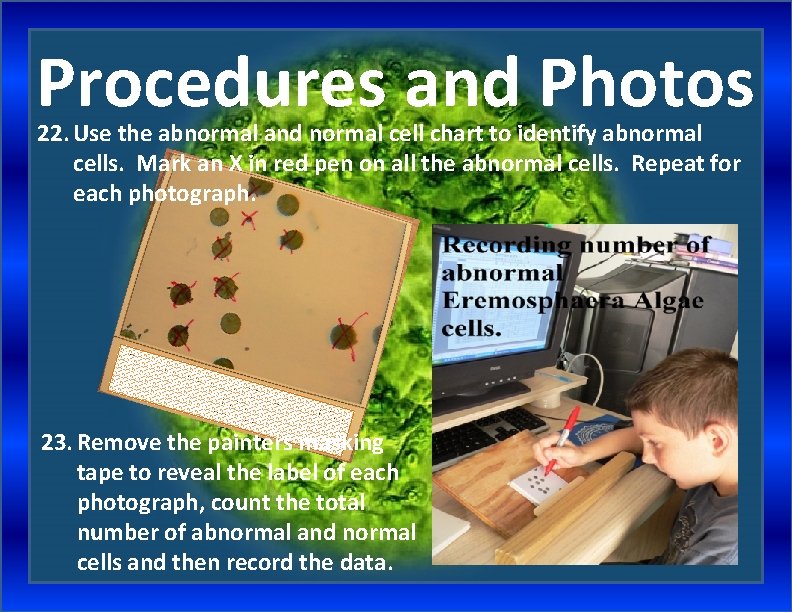 Procedures and Photos 22. Use the abnormal and normal cell chart to identify abnormal