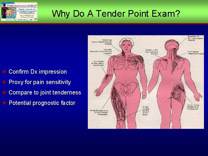 Why Do A Tender Point Exam? ► Confirm Dx impression ► Proxy for pain