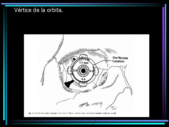 Vértice de la orbita. 