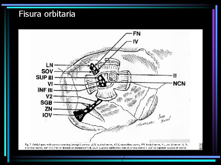 Fisura orbitaria 