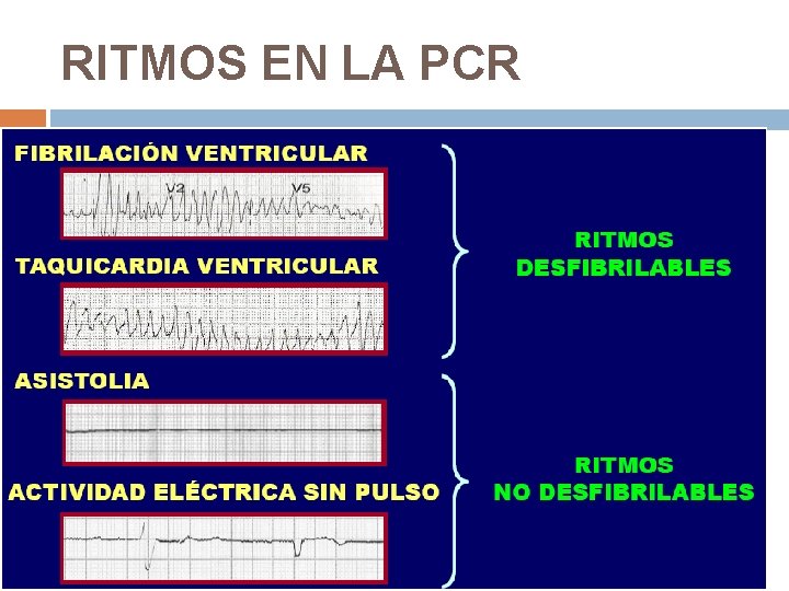 RITMOS EN LA PCR 