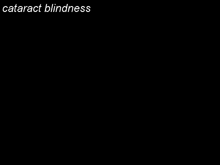 cataract blindness Nearly 40 million people in the world are blind. Cataracts are the