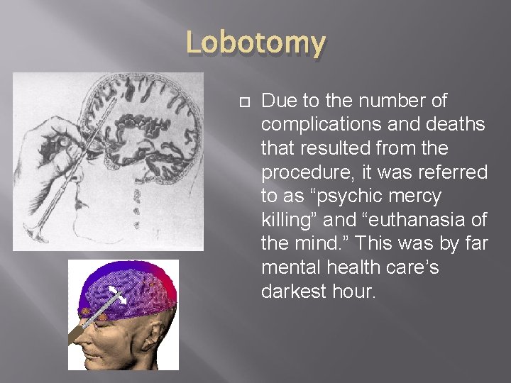 Lobotomy Due to the number of complications and deaths that resulted from the procedure,