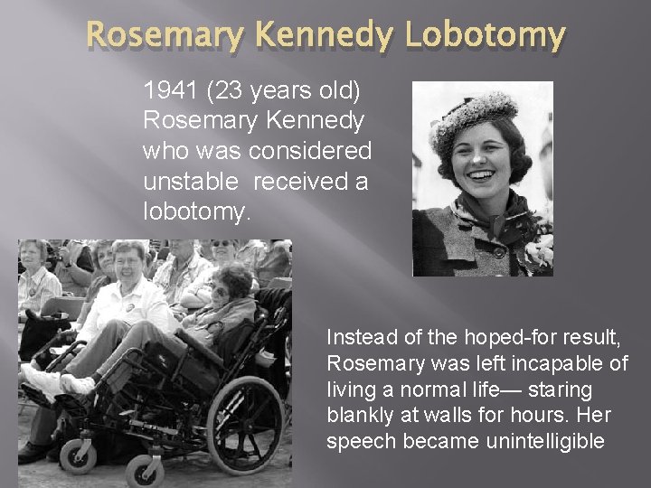 Rosemary Kennedy Lobotomy 1941 (23 years old) Rosemary Kennedy who was considered unstable received
