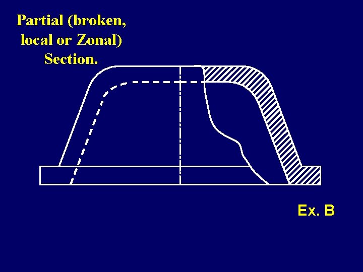 Partial (broken, local or Zonal) Section. Ex. B 