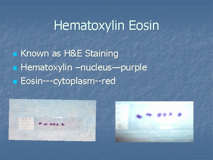 Hematoxylin Eosin n Known as H&E Staining Hematoxylin –nucleus—purple Eosin---cytoplasm--red 