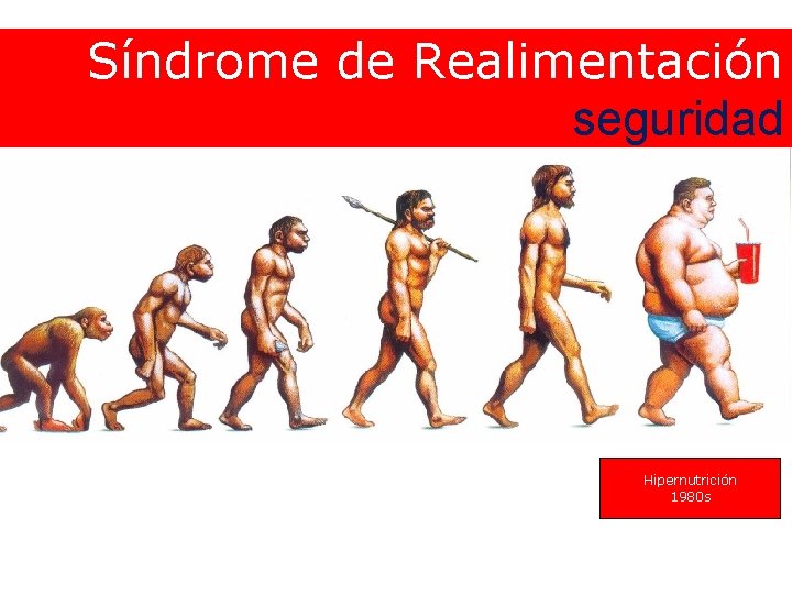 Síndrome de Realimentación seguridad Hipernutrición 1980 s 