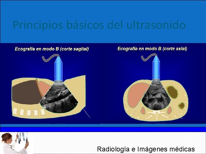 Principios básicos del ultrasonido Radiología e Imágenes médicas 