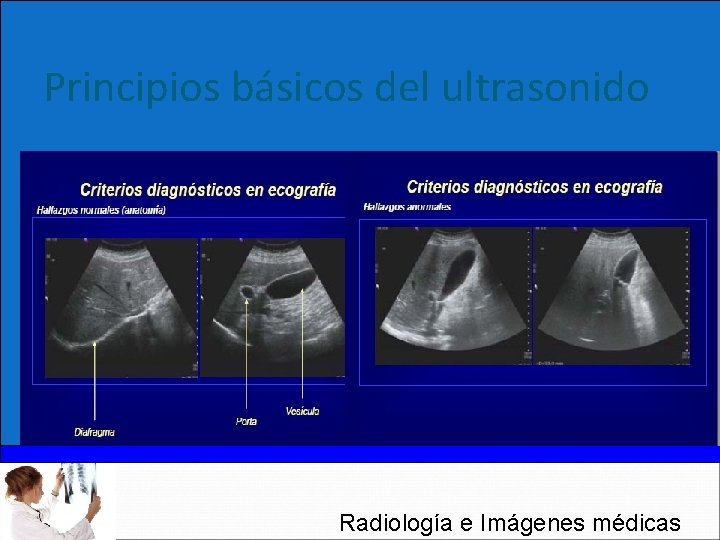 Principios básicos del ultrasonido Radiología e Imágenes médicas 