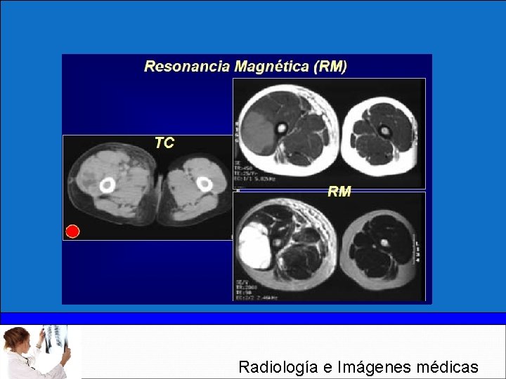Radiología e Imágenes médicas 