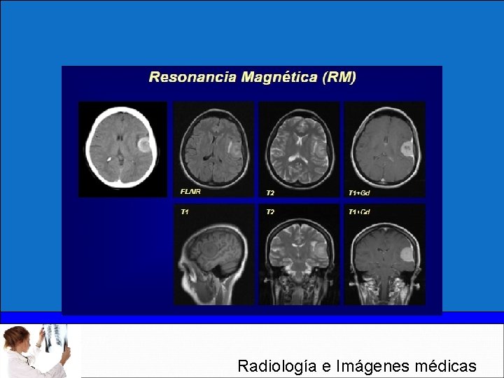 Radiología e Imágenes médicas 