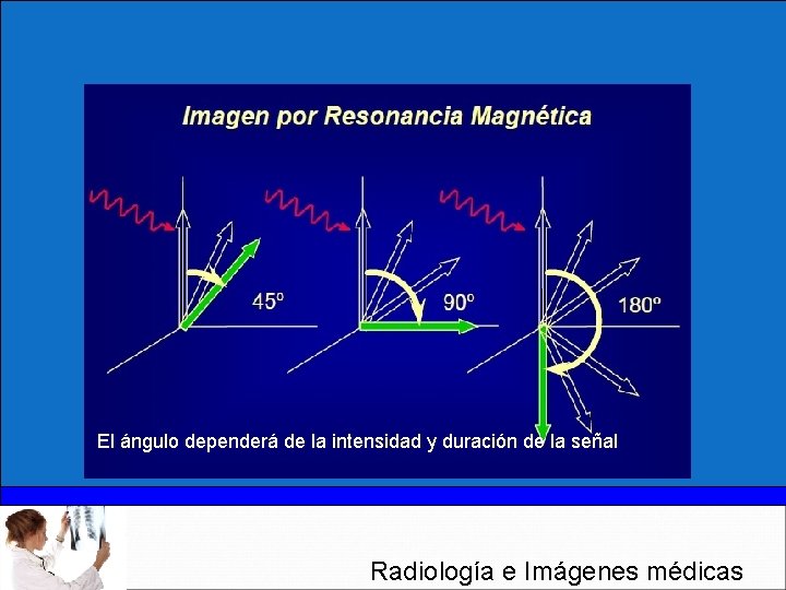 El ángulo dependerá de la intensidad y duración de la señal Radiología e Imágenes