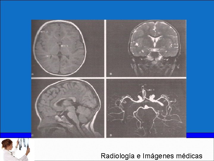 Radiología e Imágenes médicas 