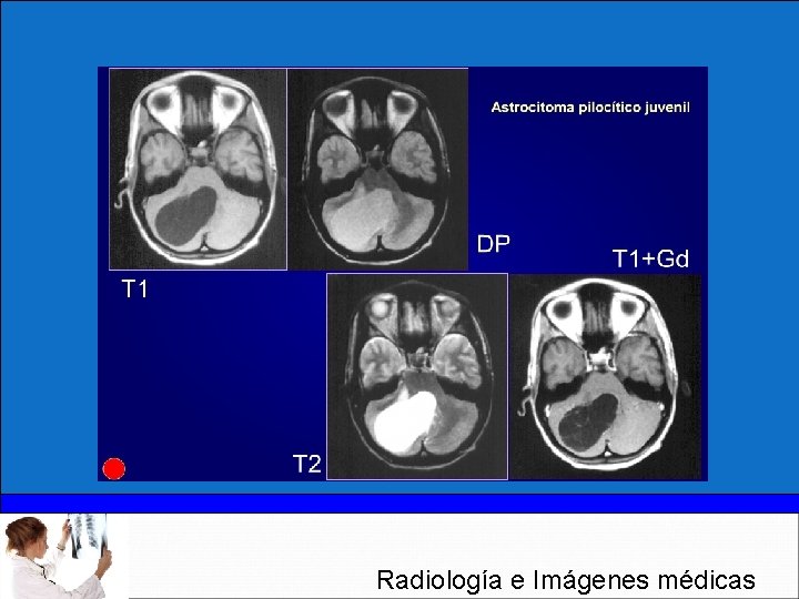 Radiología e Imágenes médicas 