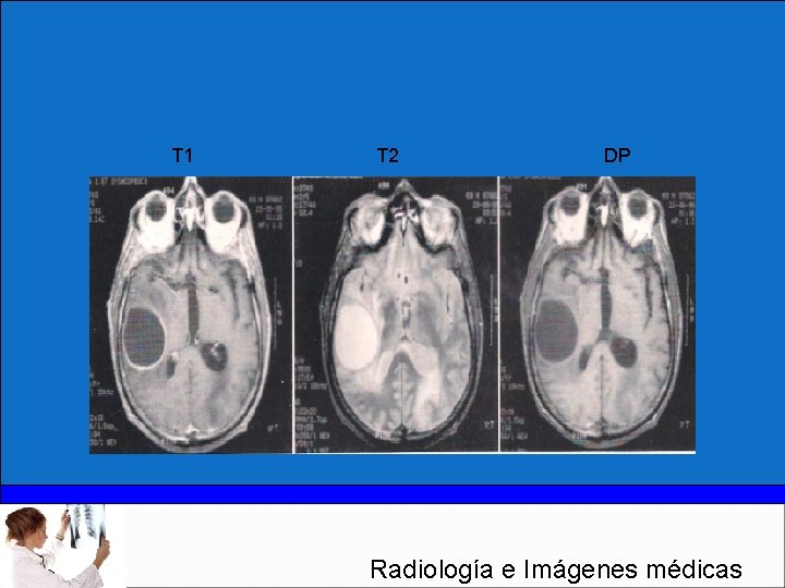 T 1 T 2 DP Radiología e Imágenes médicas 