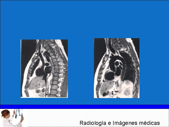 Radiología e Imágenes médicas 