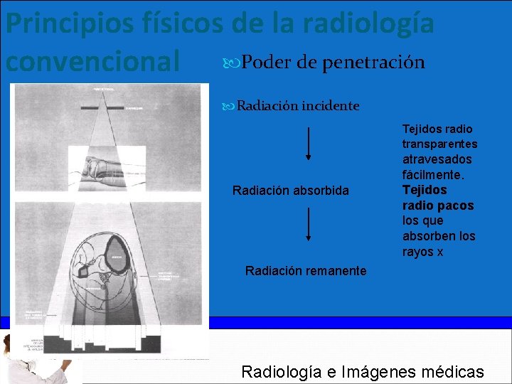 Principios físicos de la radiología convencional Poder de penetración Radiación incidente Tejidos radio transparentes