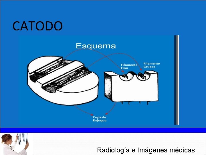 CATODO Radiología e Imágenes médicas 