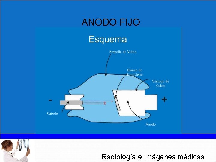 ANODO FIJO Radiología e Imágenes médicas 