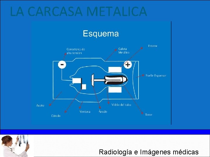 LA CARCASA METALICA Radiología e Imágenes médicas 