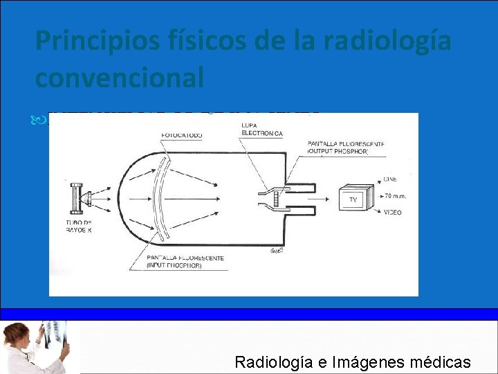 Principios físicos de la radiología convencional INTENSIFICADOR DE IMAGENES Radiología e Imágenes médicas 