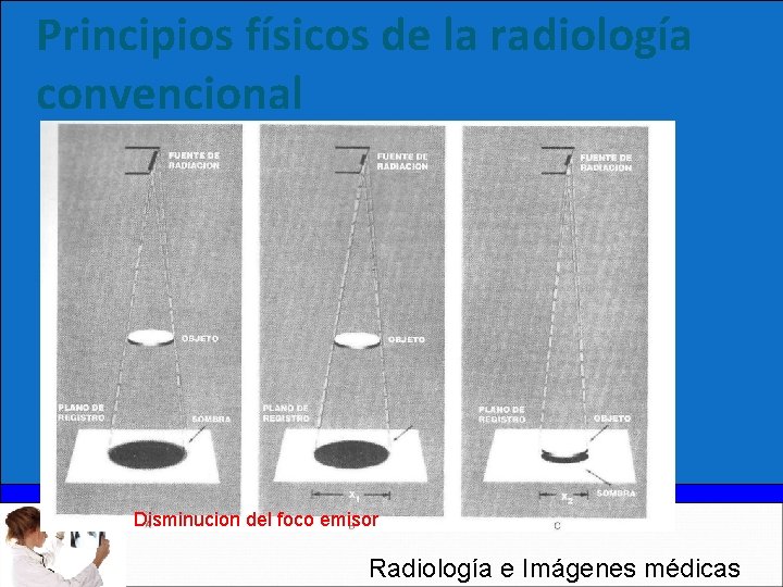 Principios físicos de la radiología convencional Disminucion del foco emisor Radiología e Imágenes médicas