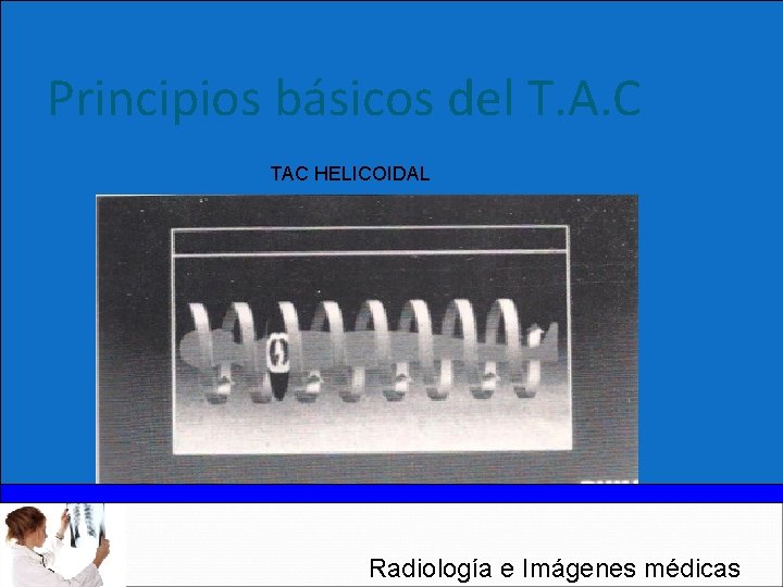 Principios básicos del T. A. C TAC HELICOIDAL Radiología e Imágenes médicas 