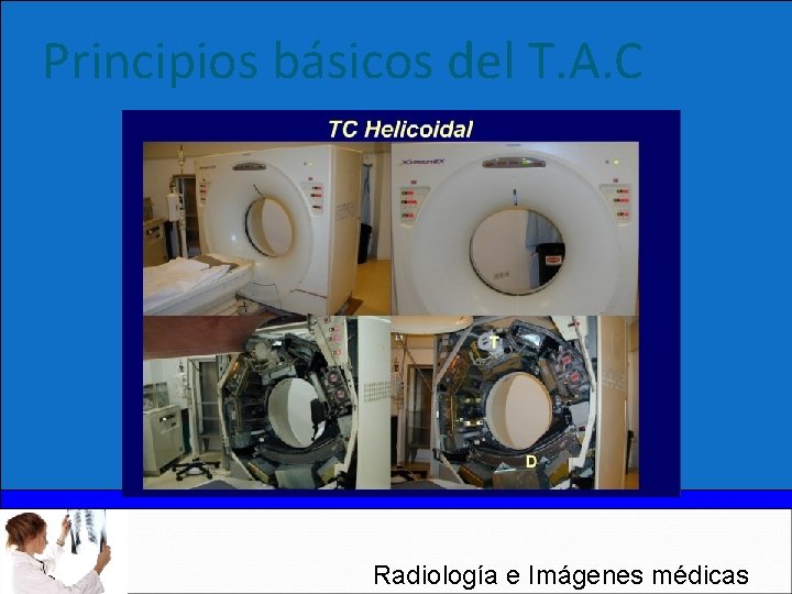 Principios básicos del T. A. C Radiología e Imágenes médicas 