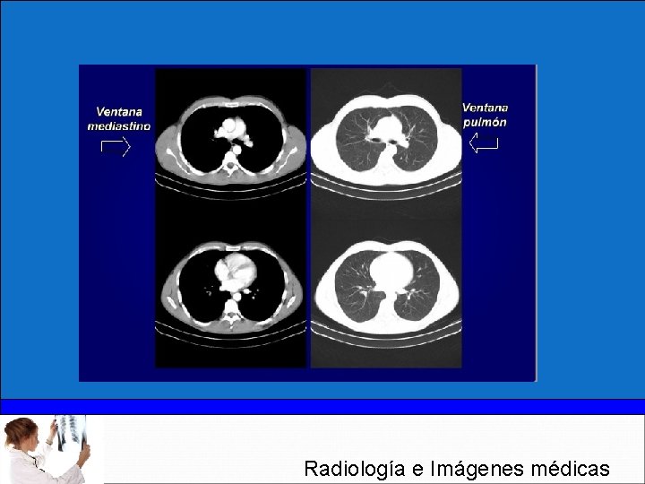 Radiología e Imágenes médicas 