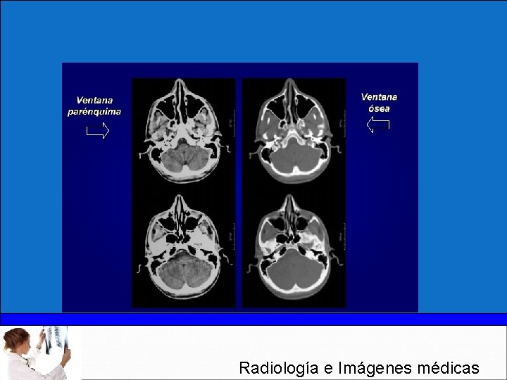 Radiología e Imágenes médicas 