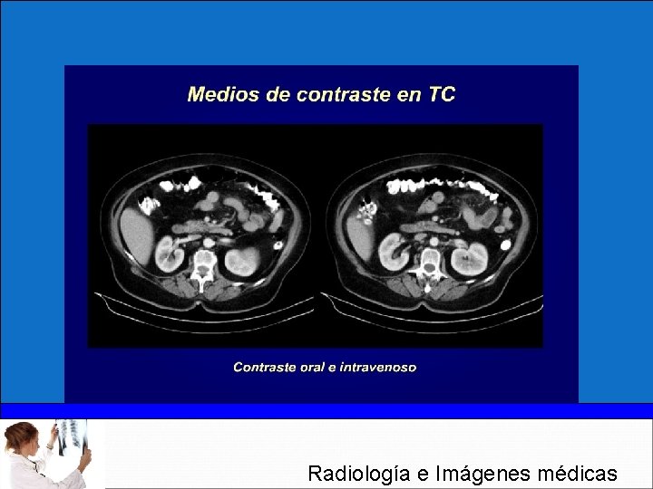 Radiología e Imágenes médicas 