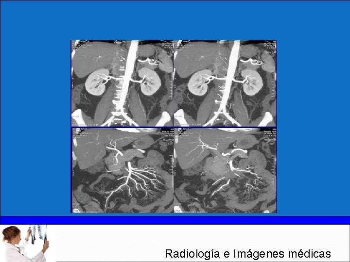 Radiología e Imágenes médicas 