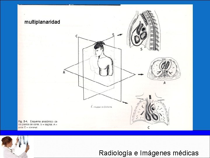 multiplanaridad Radiología e Imágenes médicas 