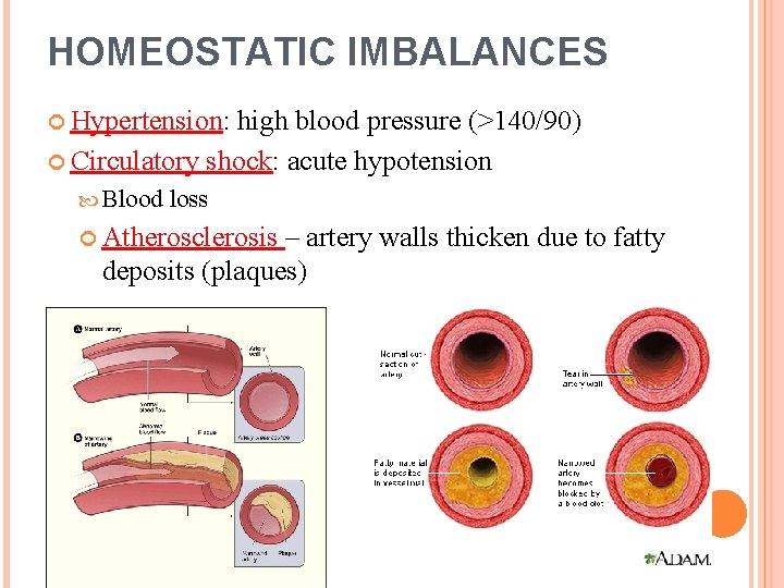 HOMEOSTATIC IMBALANCES Hypertension: high blood pressure (>140/90) Circulatory shock: acute hypotension Blood loss Atherosclerosis