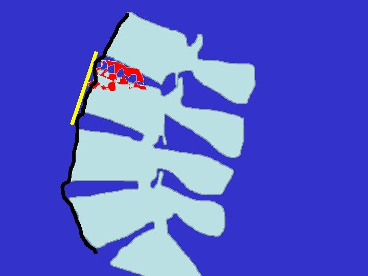 sagittal balance