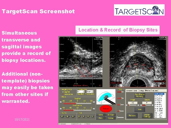 Target. Scan Screenshot Simultaneous transverse and sagittal images provide a record of biopsy locations.